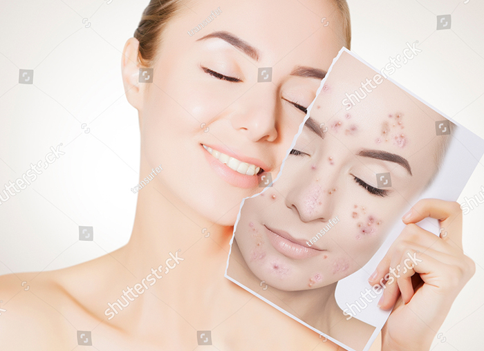 Romrawin