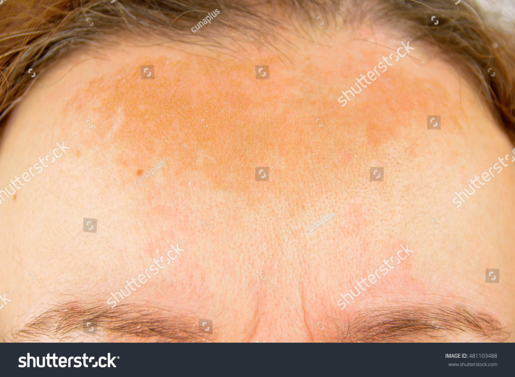 Romrawin