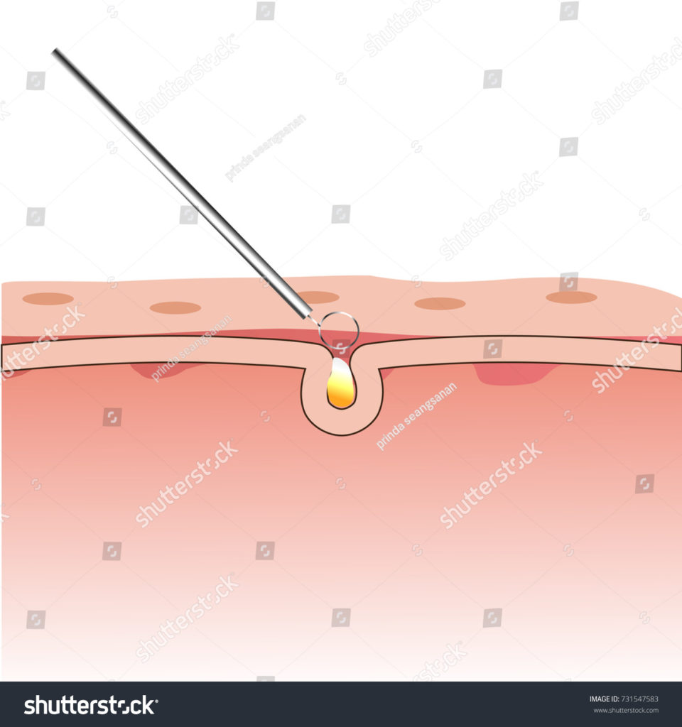 Romrawin