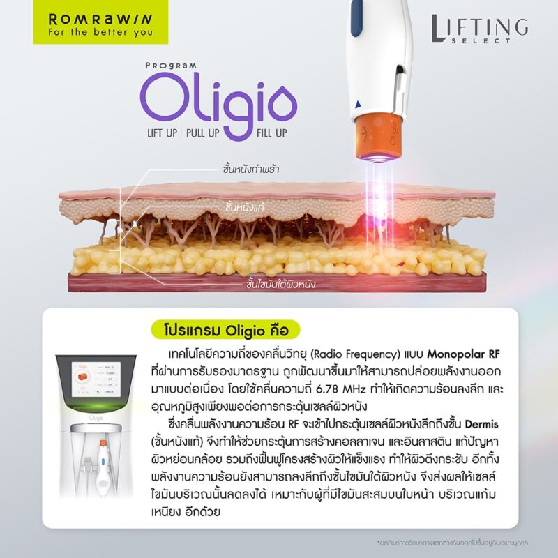 Oligio ยกกระชับคืออะไร ? ลดไขมัน ได้อย่างไร ? สร้างงานผิวได้ยังไง ? 7 โปรแกรม Oligio คืออะไร