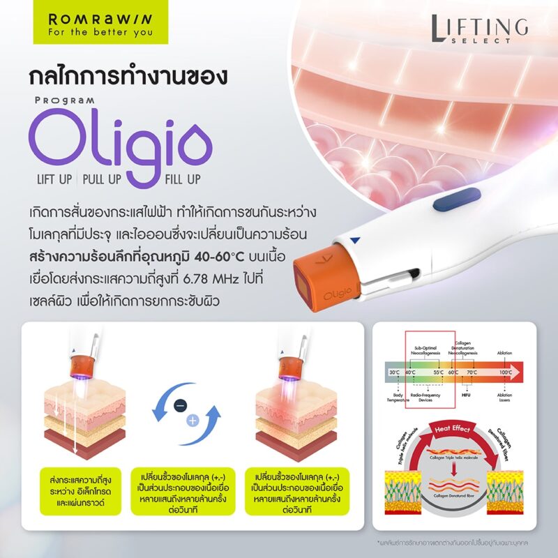 Oligio ยกกระชับคืออะไร ? ลดไขมัน ได้อย่างไร ? สร้างงานผิวได้ยังไง ? 8 การทำงานของ โปรแกรม Oligio