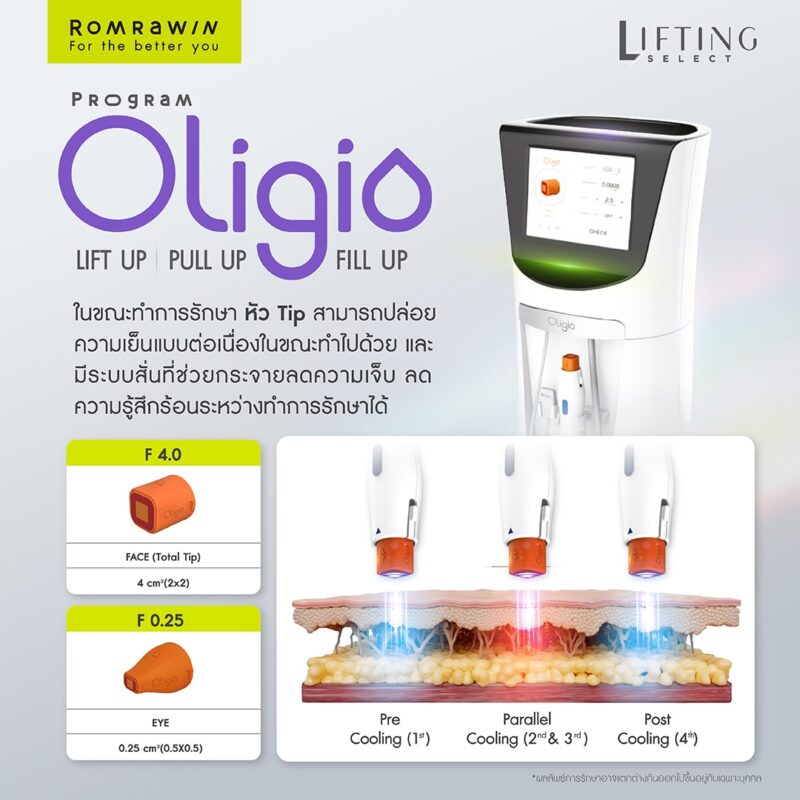 Oligio ยกกระชับคืออะไร ? ลดไขมัน ได้อย่างไร ? สร้างงานผิวได้ยังไง ? 9 เทคนิคเฉพาะตัวของโปรแกรม OLIGIO FAST MOVING TECHNIQUE