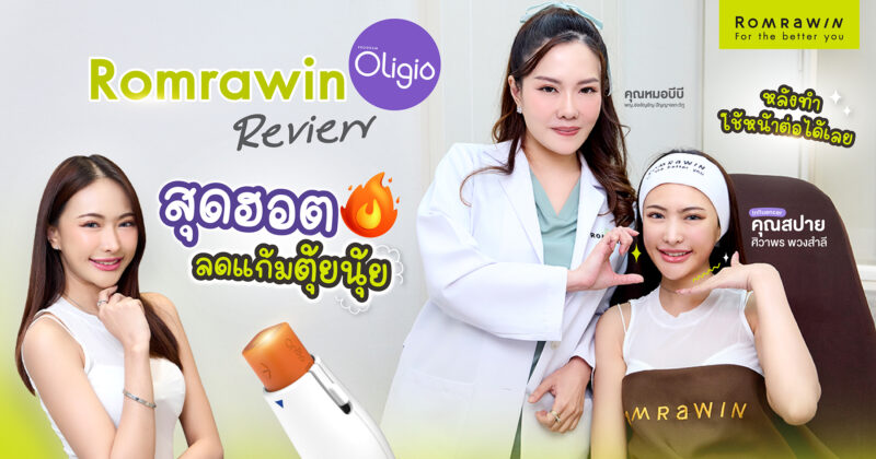 Oligio ตัวช่วยลดแก้ม