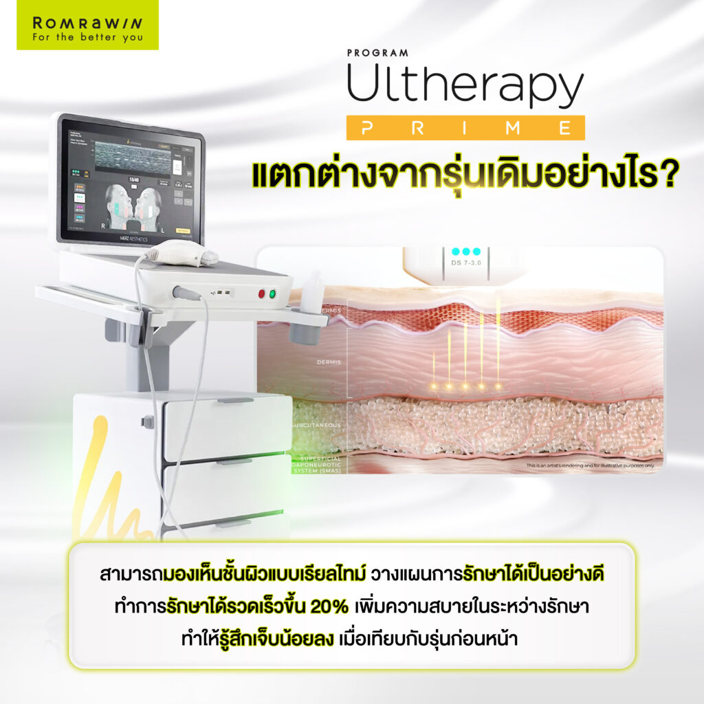 Ulthera Prime แต่ต่างจากรุ่นเดิมอย่างไร