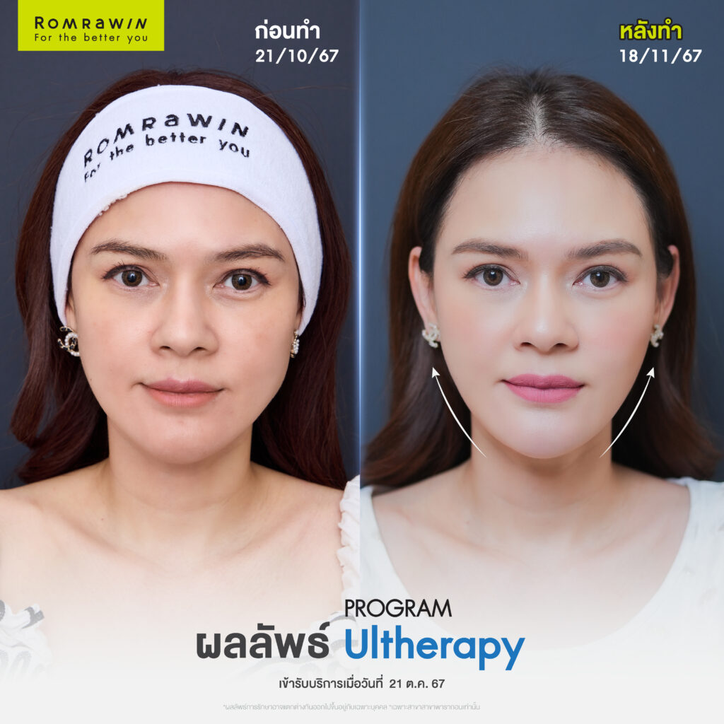 หน้าเรียวกระชับ