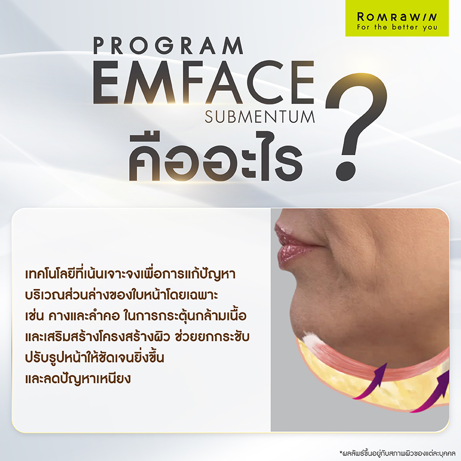 โปรแกรม EMFACE Submentum คืออะไร?