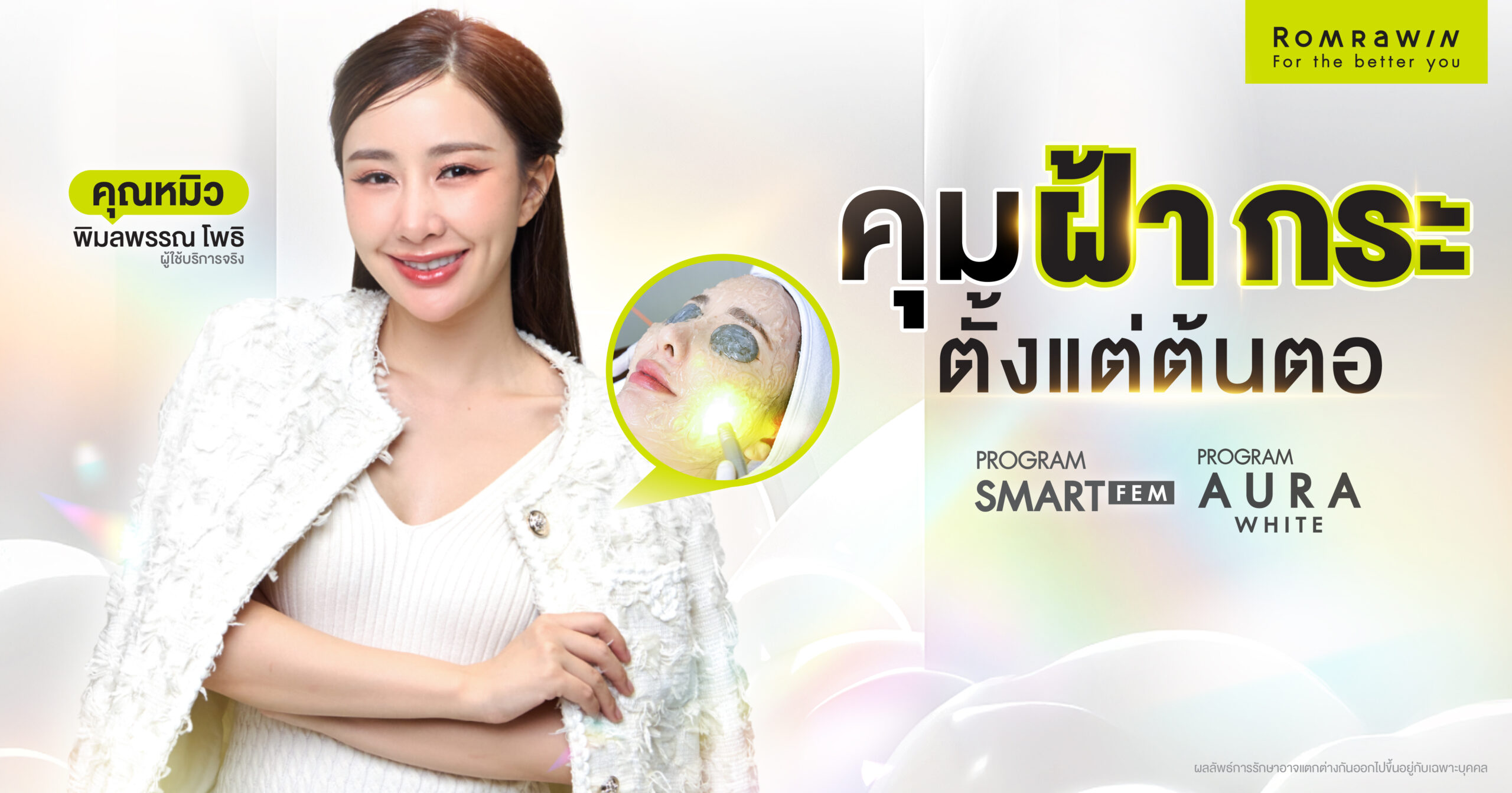 คุมฝ้า กระ