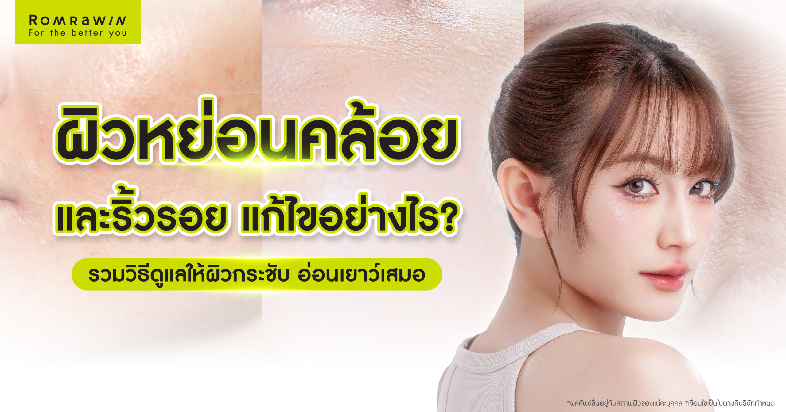 ผิวหย่อนคล้อยและริ้วรอยแต่ละช่วงวัย แก้ไขอย่างไร?