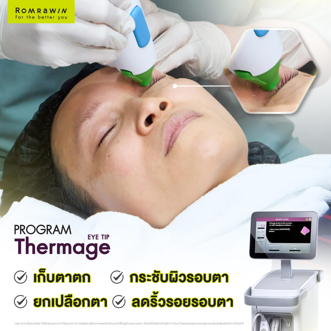 Thermage for Eye เทคโนโลยียกกระชับและแก้ปัญหารอบดวงตา