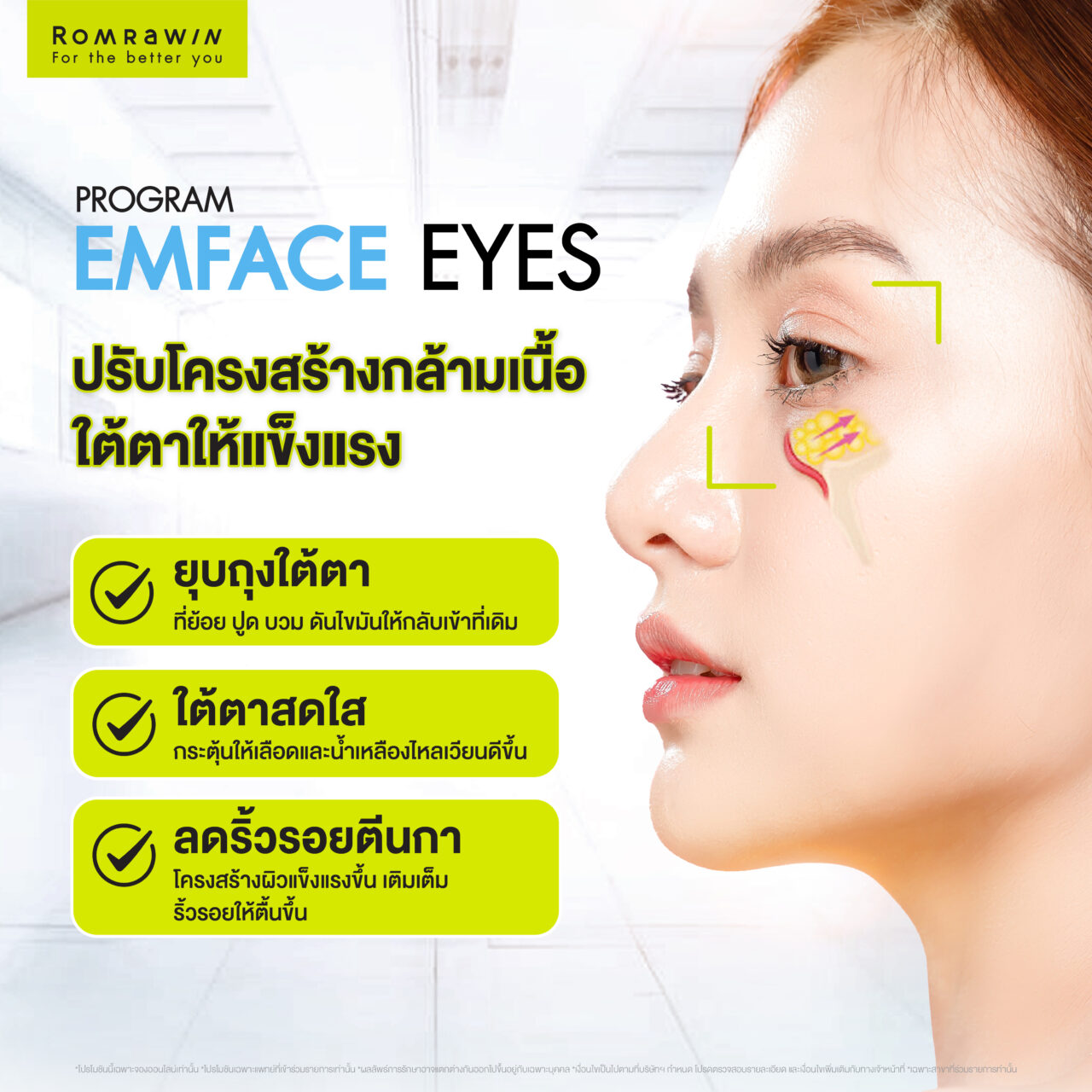 Emface Eyes ผสาน 2 เทคโนโลยีเพื่อผิวใต้ตาเฟิร์ม กระจ่างใส ดูอ่อนเยาว์ 6 ผลลัพธ์หลังการทำ Emface Eyes