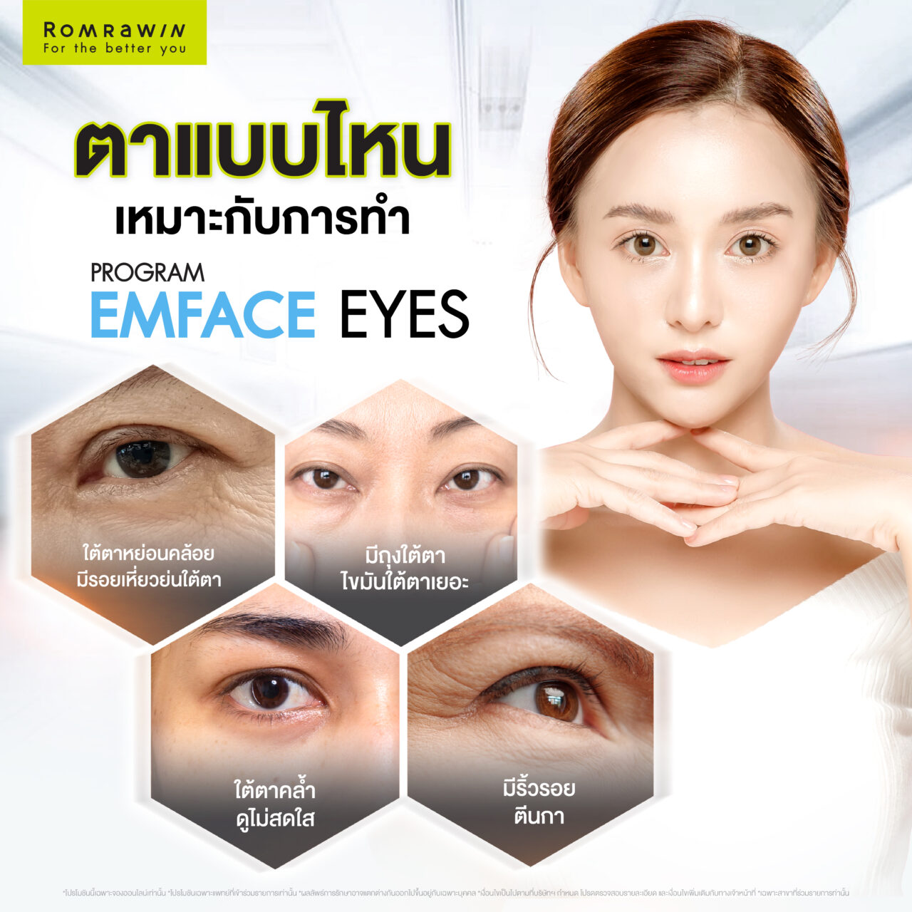 Emface Eyes ผสาน 2 เทคโนโลยีเพื่อผิวใต้ตาเฟิร์ม กระจ่างใส ดูอ่อนเยาว์ 4 ปัญหาดวงตาแบบไหนเหมาะกับการทำ Emface Eyes