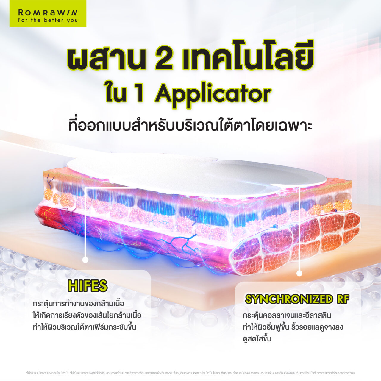 Emface Eyes ผสาน 2 เทคโนโลยีเพื่อผิวใต้ตาเฟิร์ม กระจ่างใส ดูอ่อนเยาว์ 2 Emface Eyes ประกอบไปด้วย 2 คลื่นพลังงาน