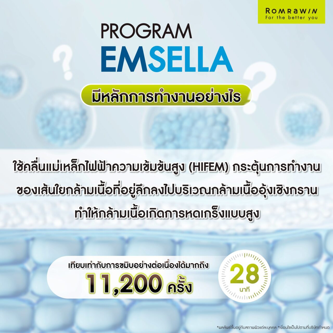 Emsella มีหลักการทำงานอย่างไร?