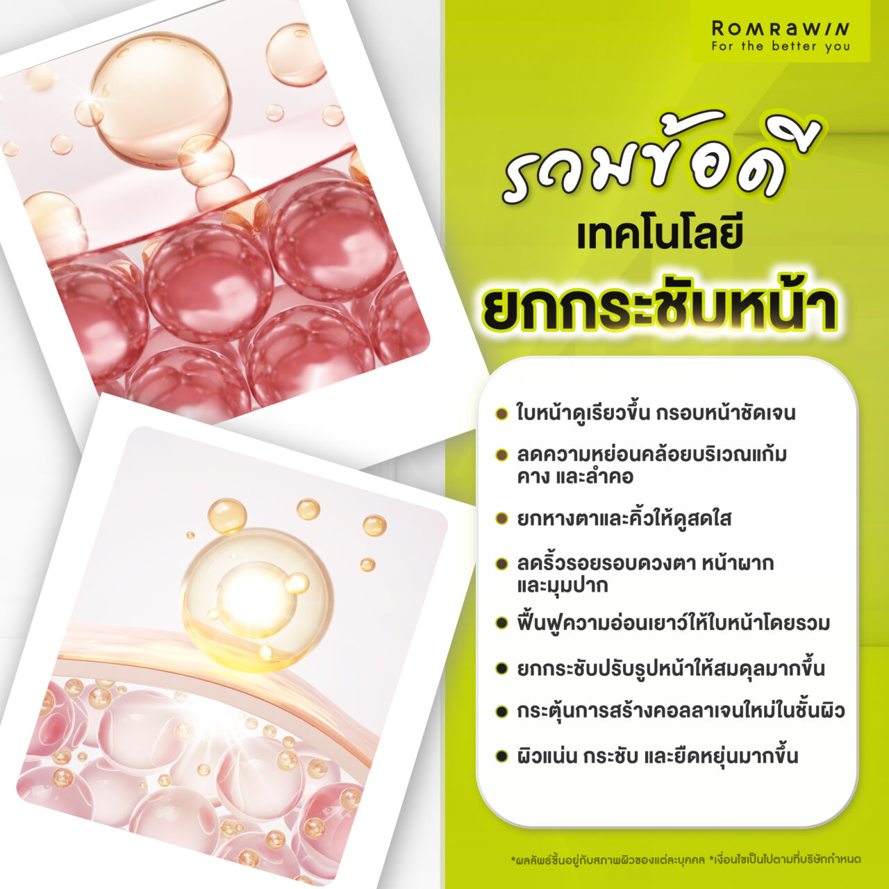 รวมข้อดีของการทำเทคโนโลยียกกระชับหน้า