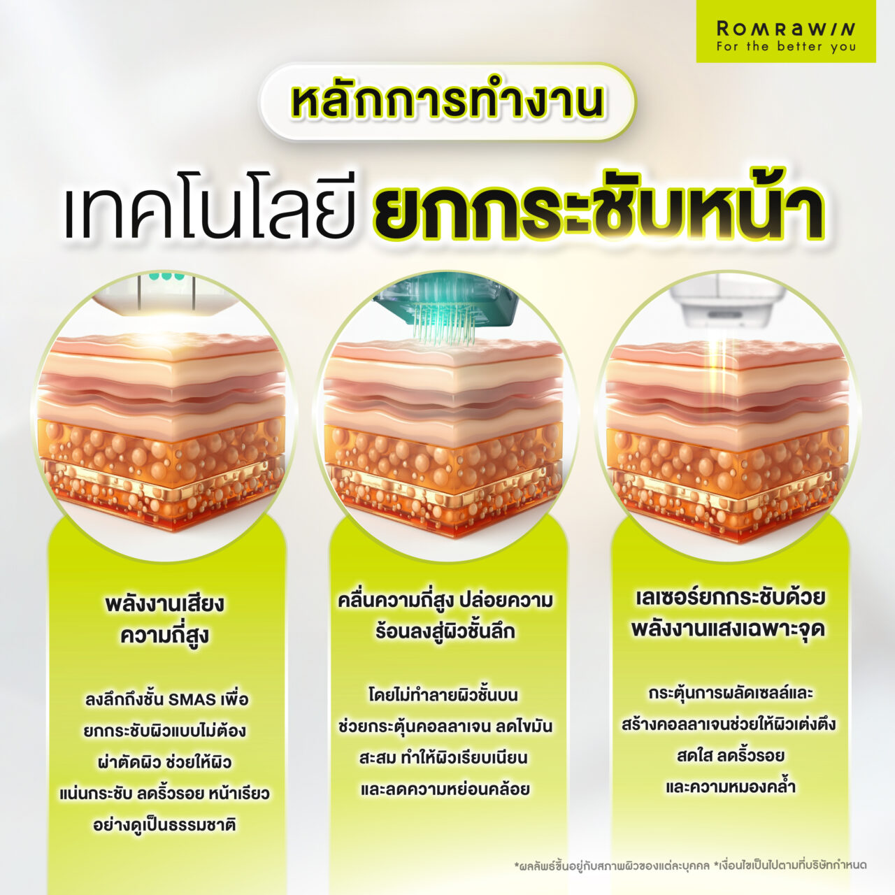 หลักการทำงานของเทคโนโลยียกกระชับหน้าแต่ละประเภท
