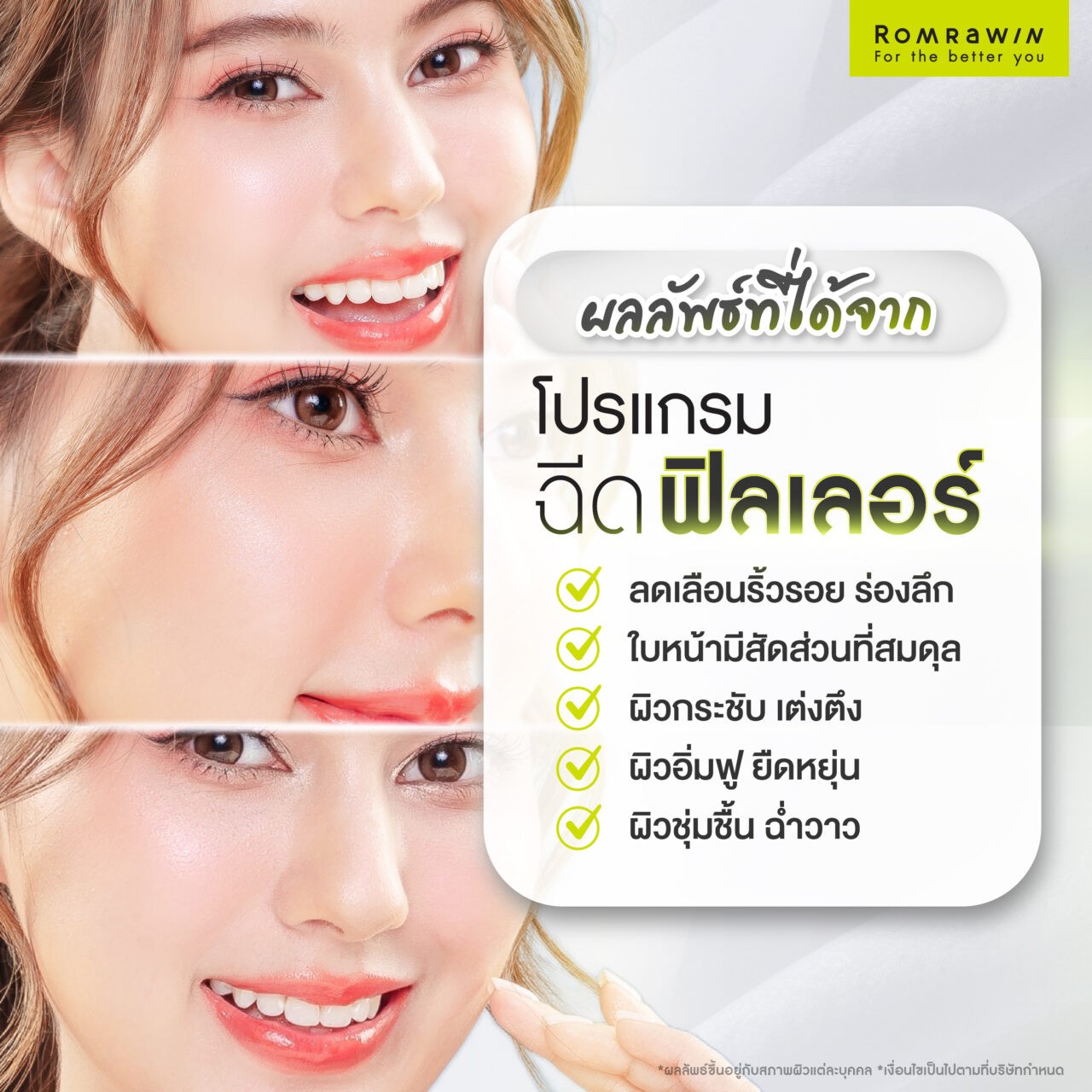 ผลลัพธ์ที่ได้จากการฉีดฟิลเลอร์