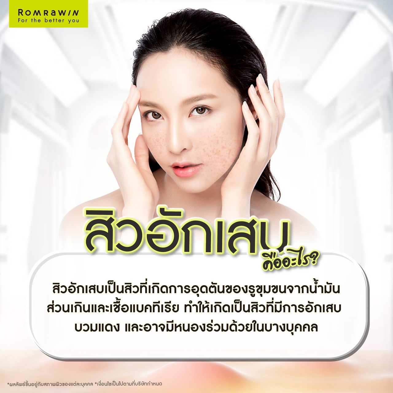 สิวอักเสบเกิดจากอะไร ?
