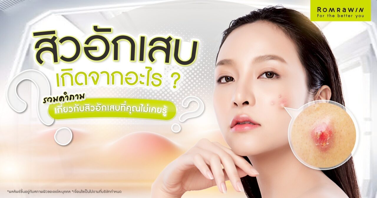สิวอักเสบเกิดจากอะไร ?