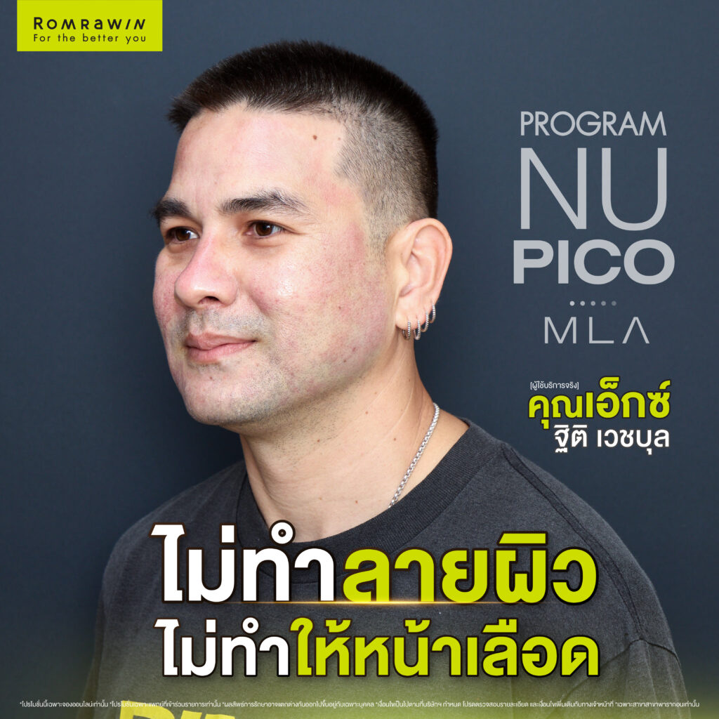 NU PICO MLA 