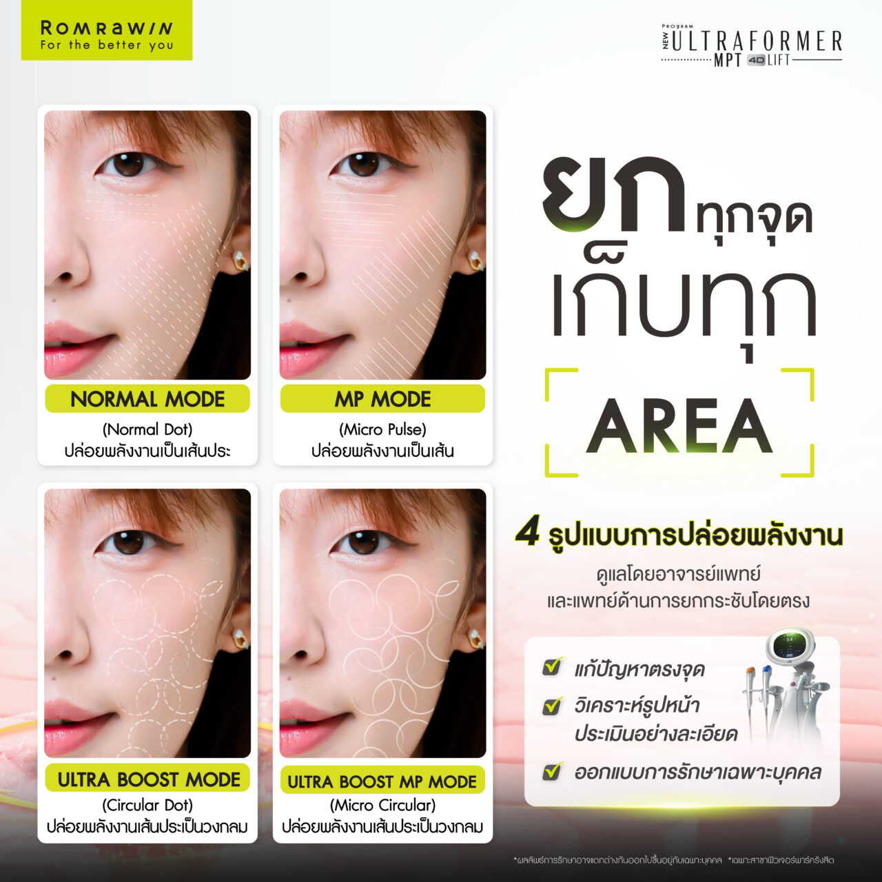 โปรแกรม Ultraformer MPT 4D LIFT ยกกระชับความหย่อนคล้อย 2 โปรแกรม Ultraformer MPT 4D LIFT ยกกระชับความหย่อนคล้อย