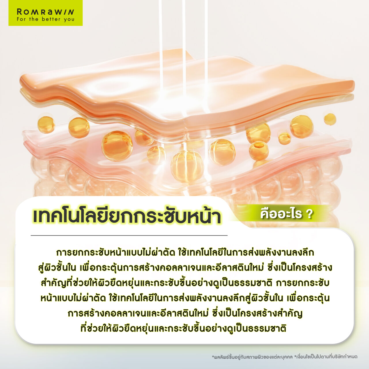 เทคโนโลยียกกระชับหน้า vs โปรแกรมฉีดฟิลเลอร์ อะไรเหมาะกับคุณมากกว่ากัน? 2 เทคโนโลยียกกระชับหน้าคืออะไร? วิธีคืนความกระชับให้ผิว ทางเลือกแบบไม่ผ่าตัด
