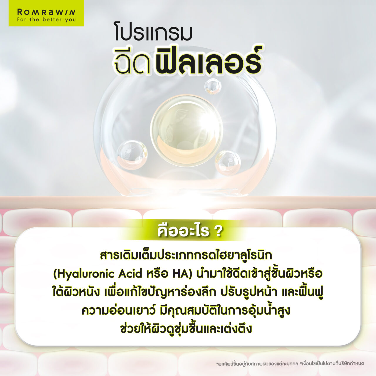 เทคโนโลยียกกระชับหน้า vs โปรแกรมฉีดฟิลเลอร์ อะไรเหมาะกับคุณมากกว่ากัน? 3 โปรแกรมฉีดฟิลเลอร์คืออะไร? เติมเต็มผิวแบบเร่งด่วนเพื่อความอ่อนเยาว์