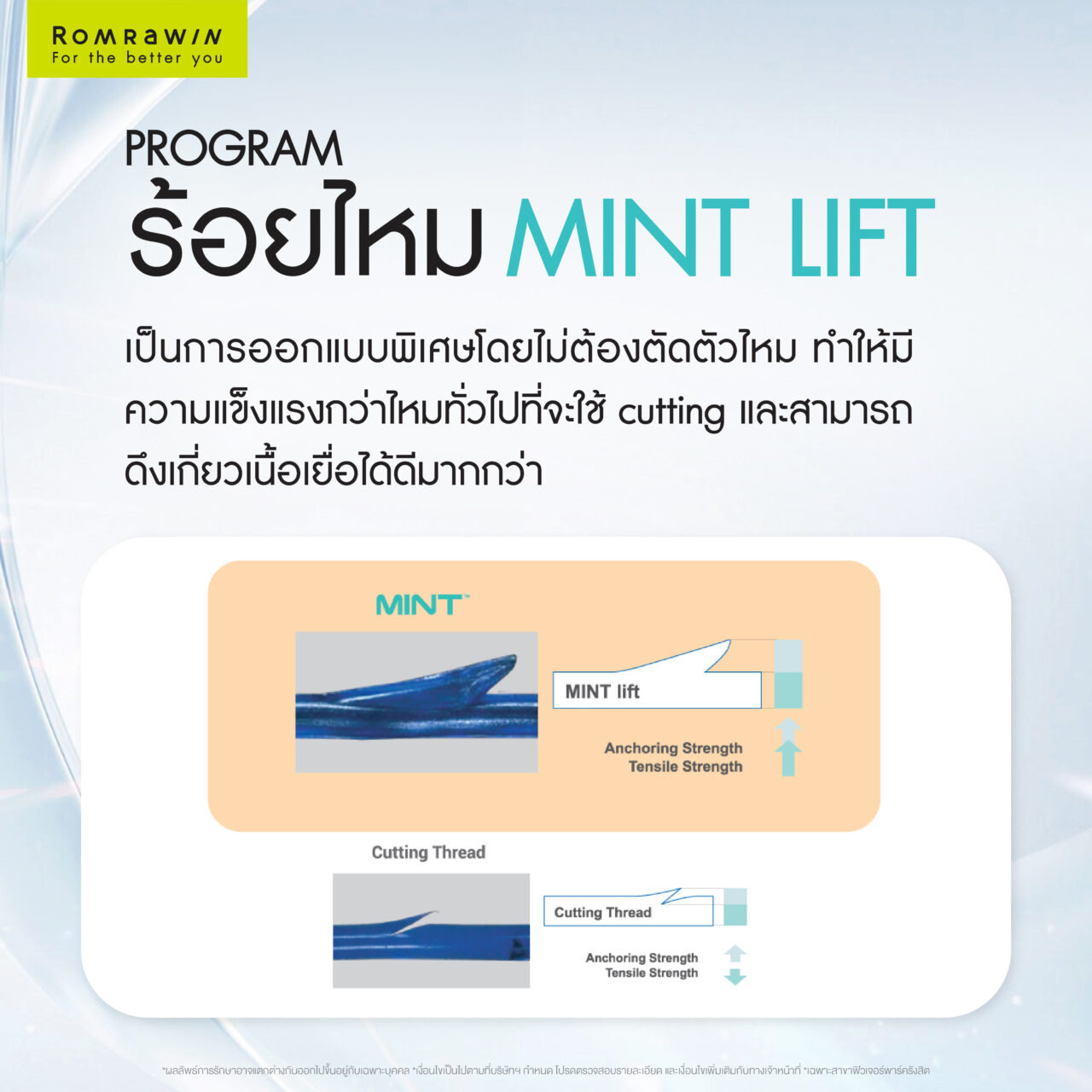 ร้อยไหม MINT Lift