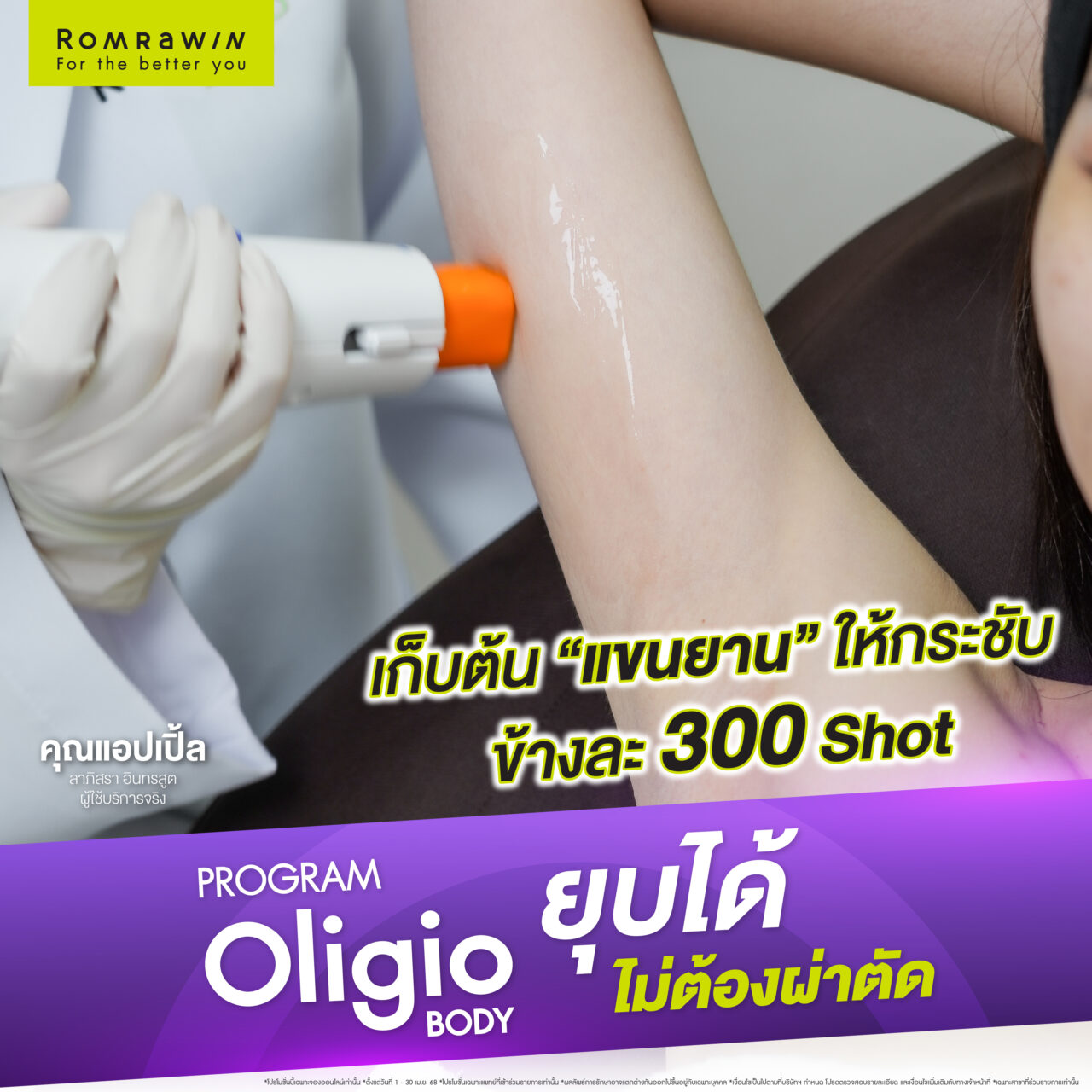 Oligio Body เลิกปลิ้น เปลี่ยนหุ่นให้เชพดี คุณแอปเปิ้ล ลาภิสรา