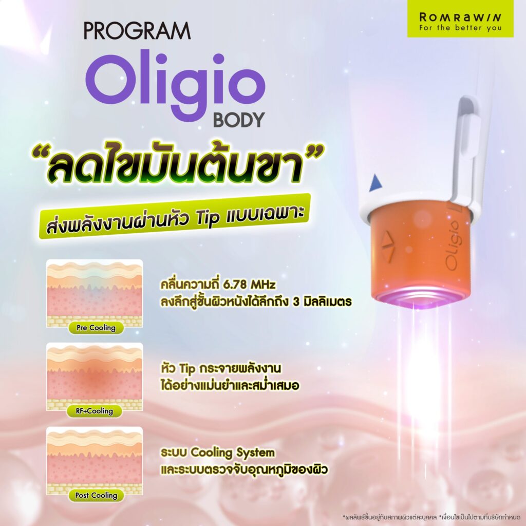 ลดไขมันต้นขาด้วย Oligio Body ส่งพลังงานผ่านหัว Tip แบบเฉพาะ