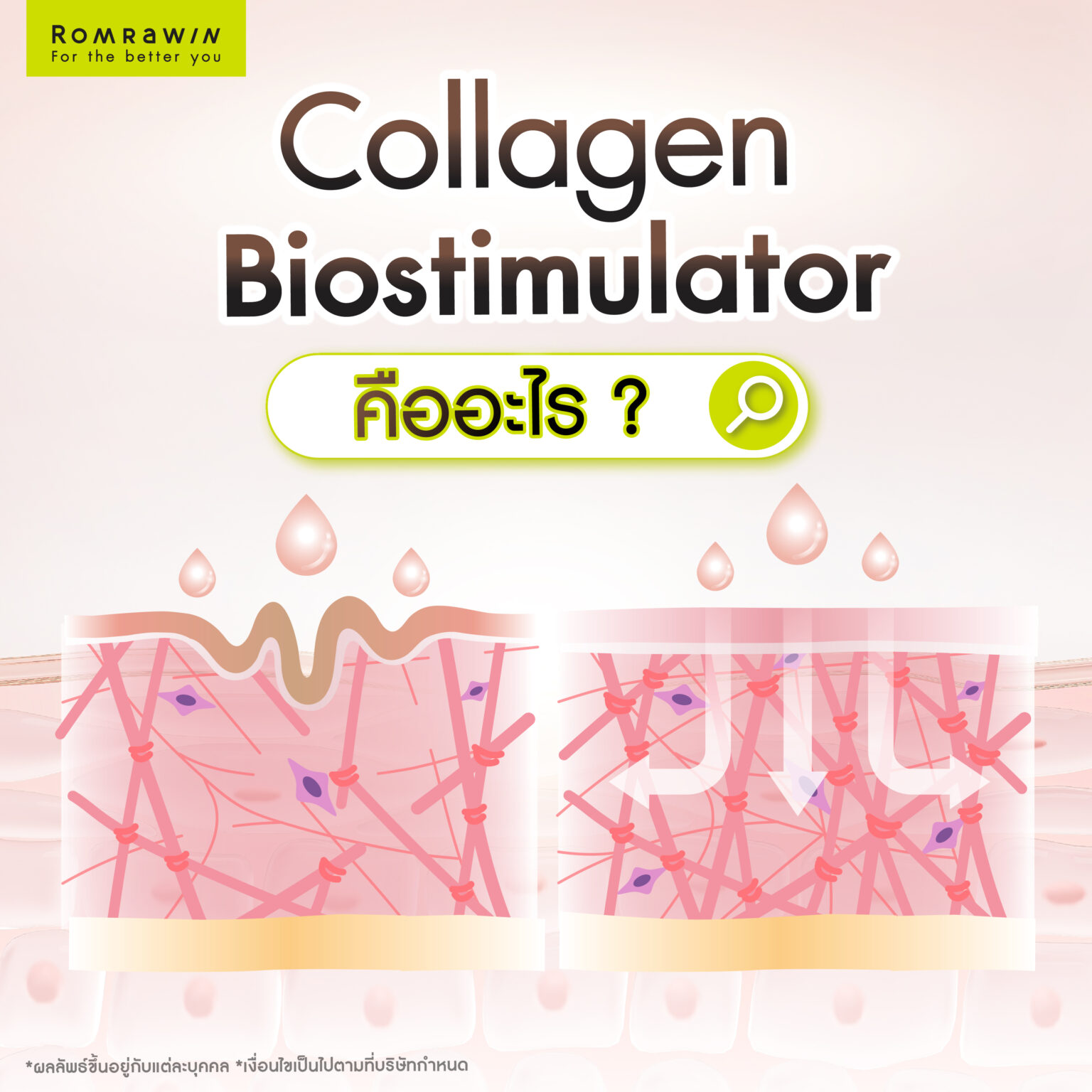 Collagen Biostimulator ทางเลือกใหม่ในการฟื้นฟูผิว คืออะไร?