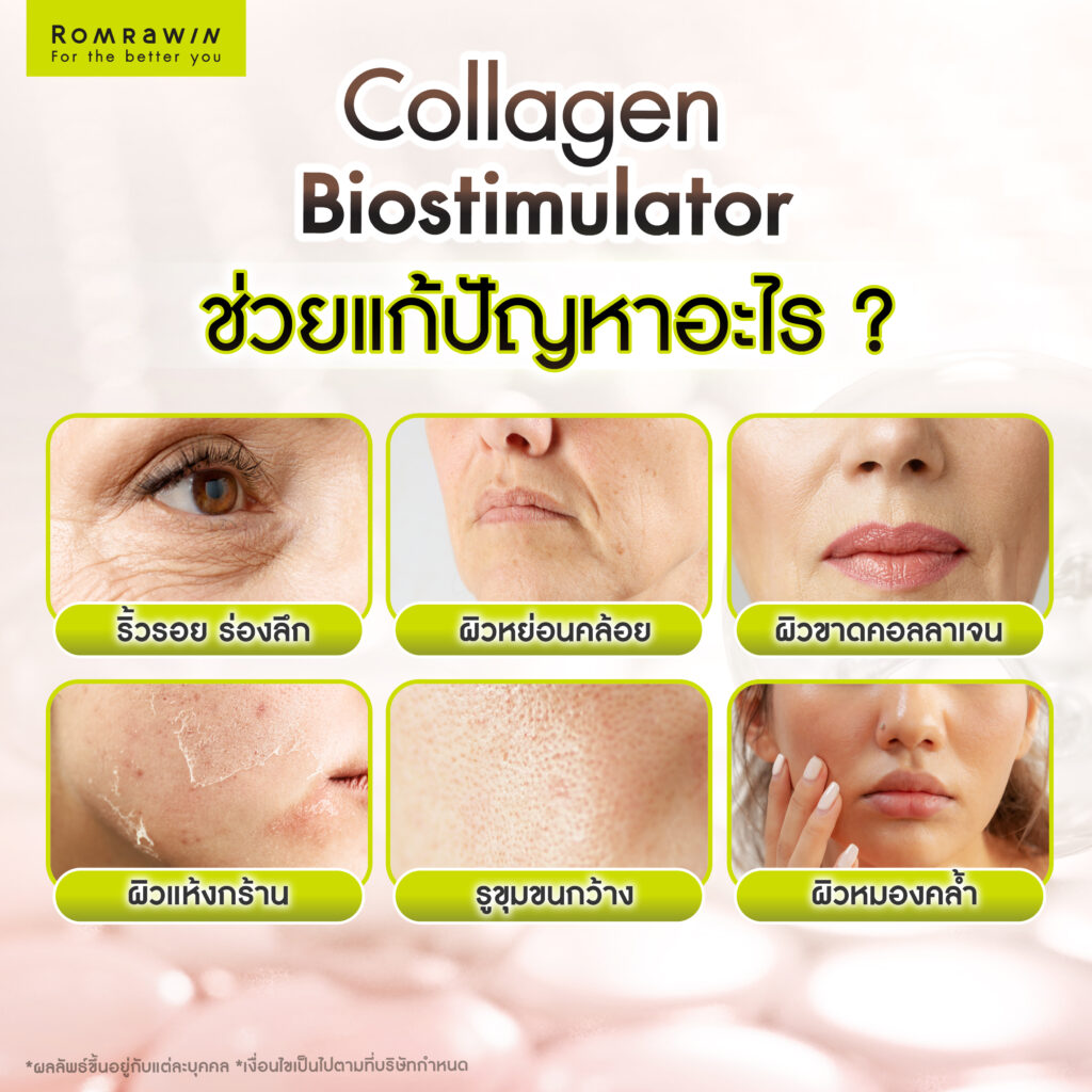 Collagen Biostimulator สารกระตุ้นคอลลาเจน ช่วยแก้ปัญหาอะไร?