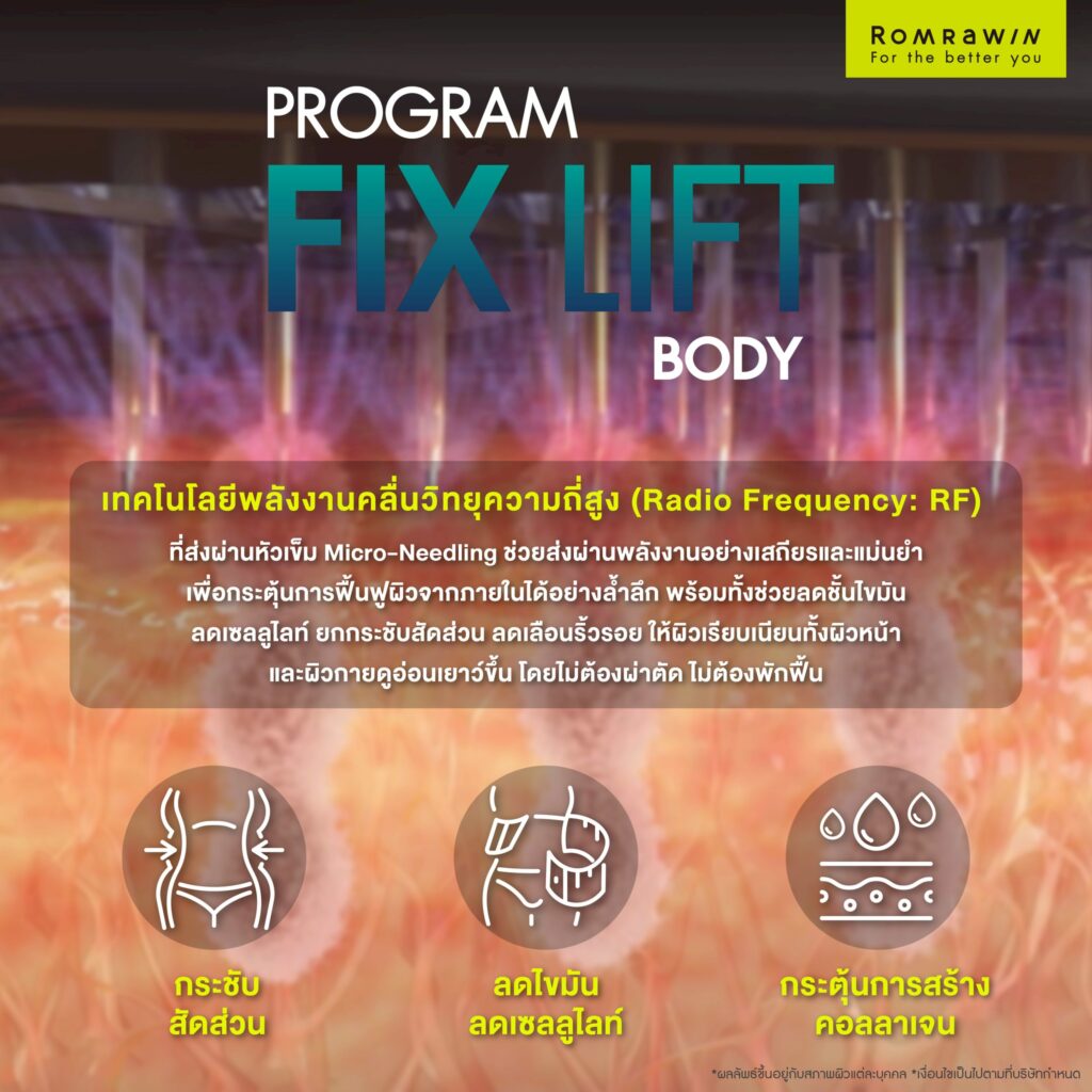 Fix Lift Body กระชับสัดส่วน คืออะไร?