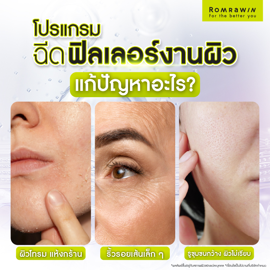 ฉีดฟิลเลอร์งานผิว แก้ไขปัญหาอะไรได้บ้าง?