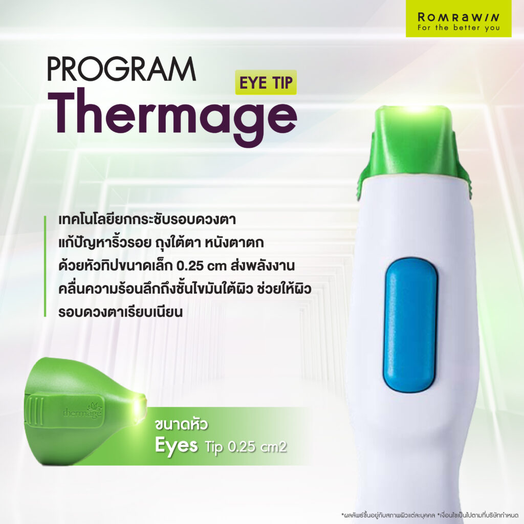 Thermage Eye เทคโนโลยียกกระชับผิวรอบดวงตา กับเรื่องที่คุณอาจสงสัย 2 Thermage Eye ยกกระชับรอบดวงตาแบบไม่ต้องผ่าตัด