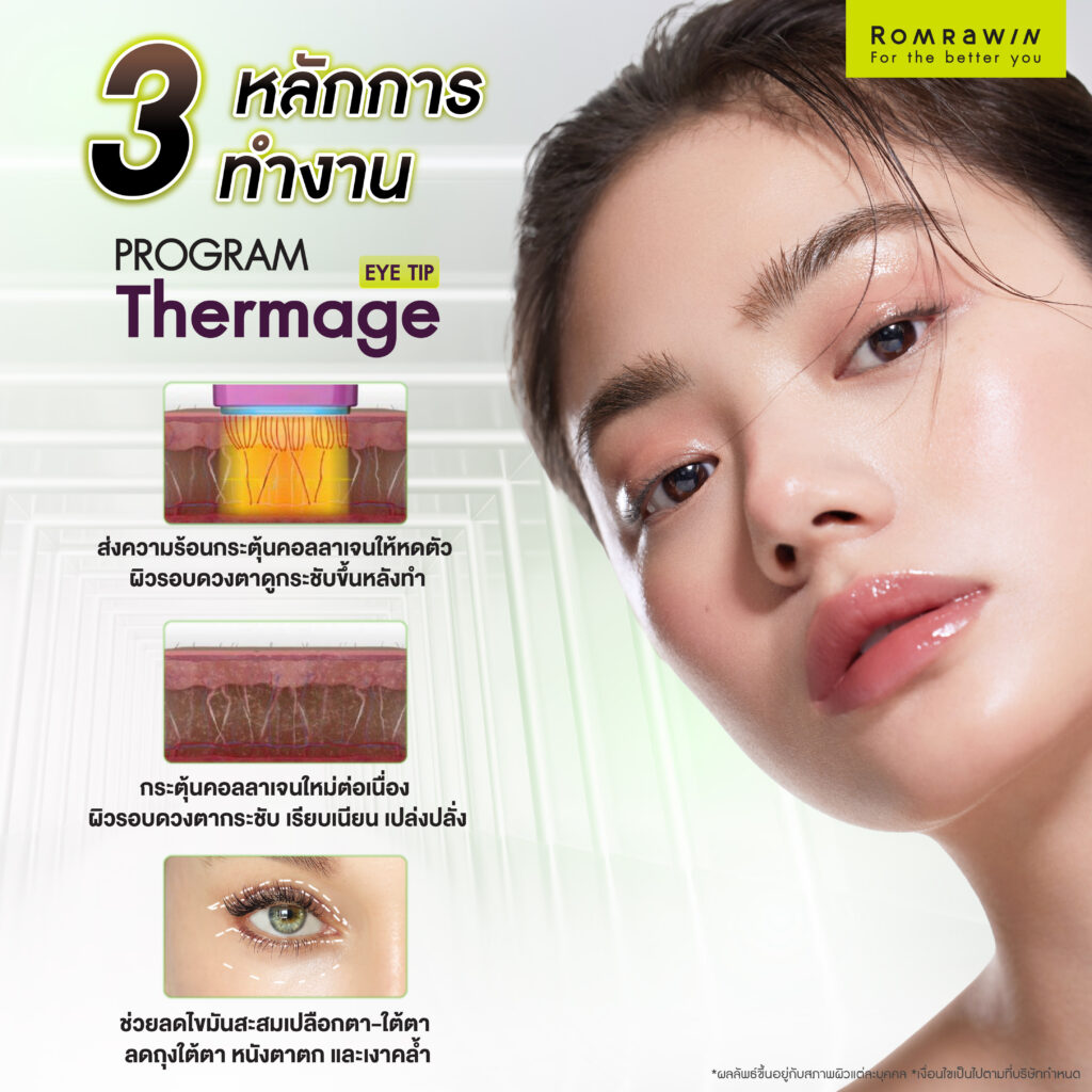 กลไกการทำงานของ Thermage Eye ยกกระชับรอบดวงตาแบบลึกถึงชั้นผิว
