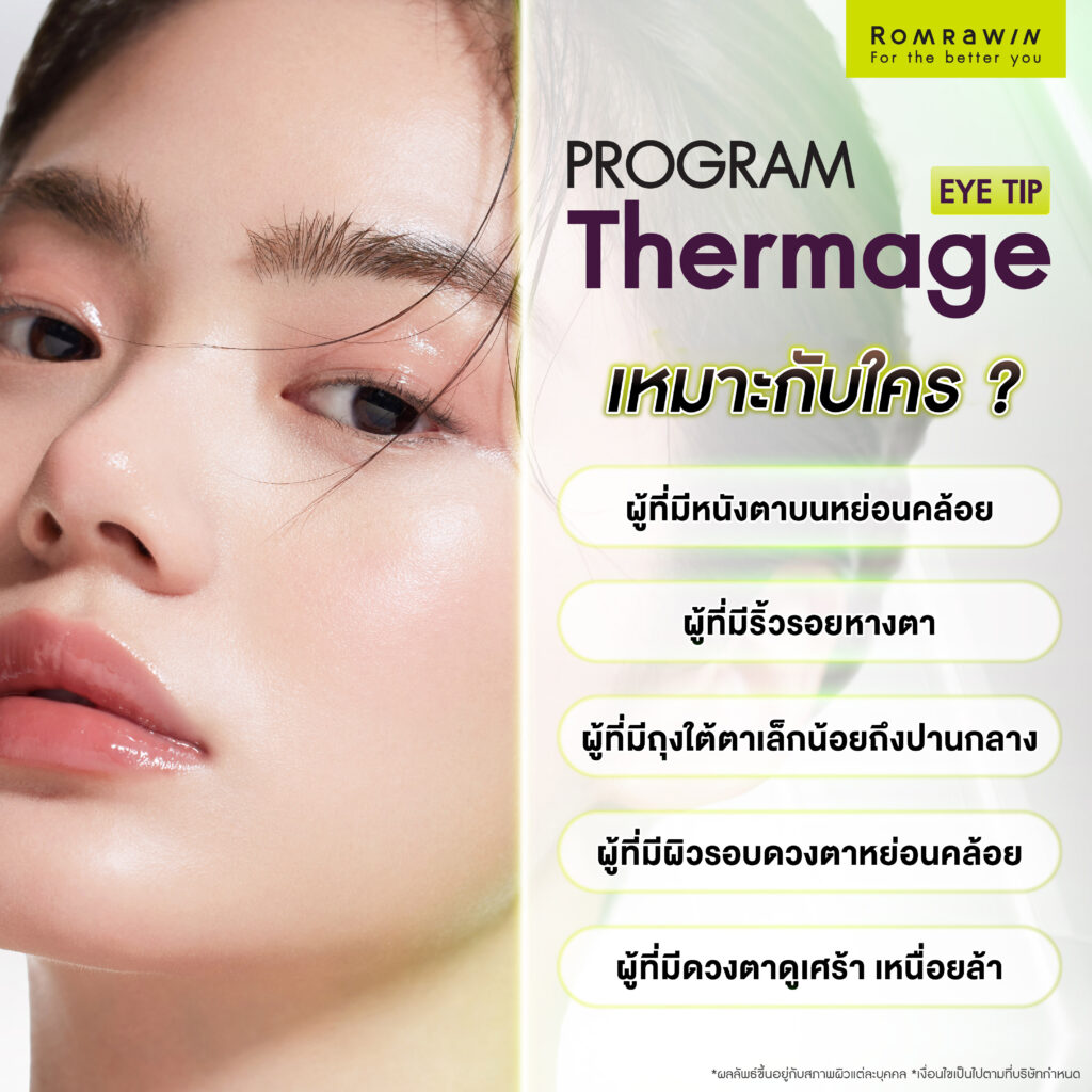 Thermage Eye เหมาะกับใครบ้าง?