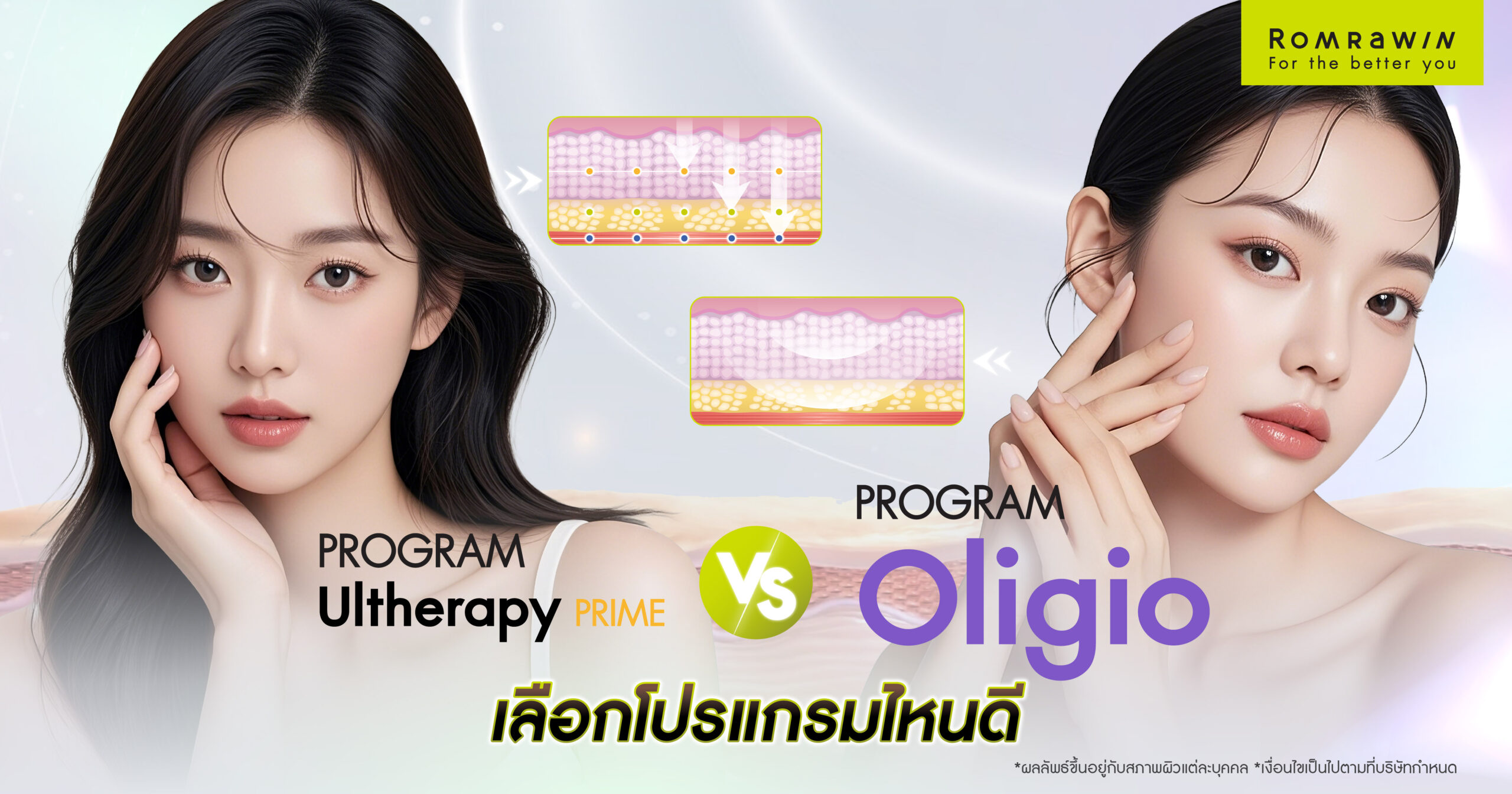 Ultherapy Prime vs Oligio โปรแกรมหน้าเรียวกระชับที่มาแรงในปีนี้ เลือกอะไรดี?