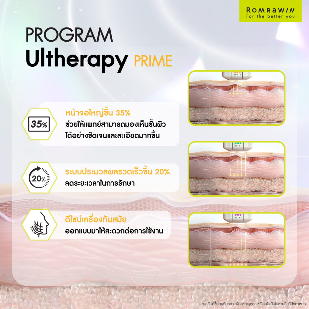 ทำความรู้จักกับ Ultherapy Prime 
