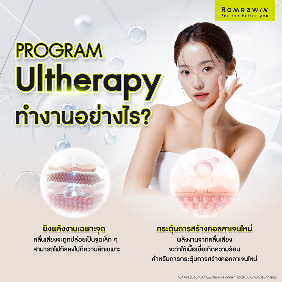 Ultherapy (อัลเทอราปี) ทำงานอย่างไร?