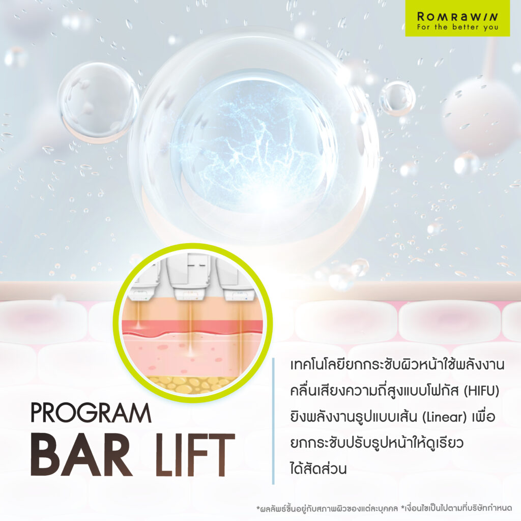 Bar Lift คืออะไร?