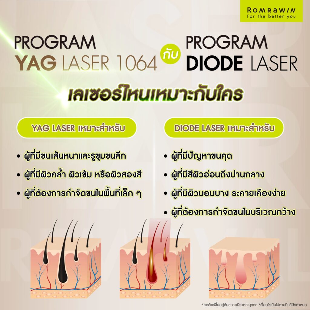 YAG Laser กับ Diode Laser เลเซอร์ไหนเหมาะกับใคร