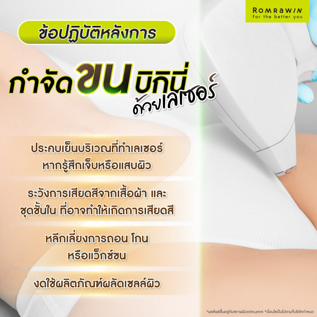 ข้อปฏิบัติหลังการกำจัดขนบิกินี่ด้วยเลเซอร์