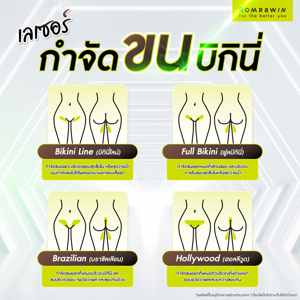 เลเซอร์กำจัดขนบิกินี่มีกี่รูปแบบ ? ต่างกันอย่างไร