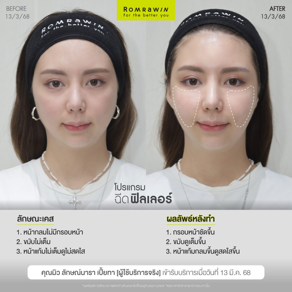 เติมนิด ปรับหน่อย หน้าละมุนแบบไม่โป๊ะคุณมิวลักษณ์นารา