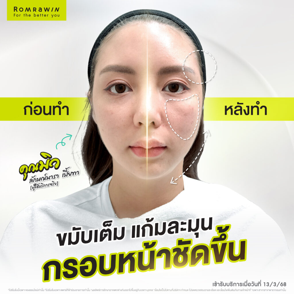 เติมนิด ปรับหน่อย หน้าละมุนแบบไม่โป๊ะคุณมิวลักษณ์นารา