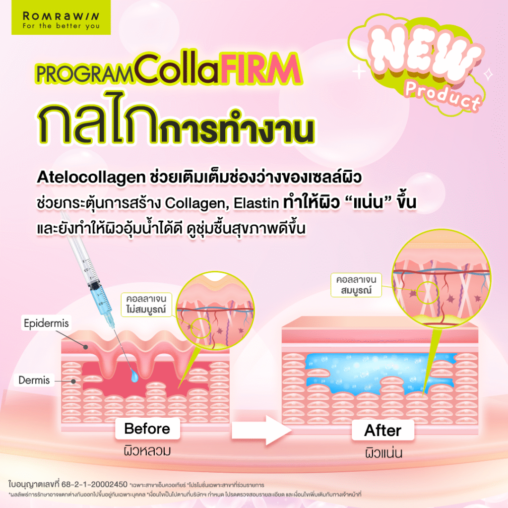 Collaju ทำความรู้จักคอลลาเจนบริสุทธิ์ที่ช่วยในการฟื้นฟูผิว 2 กลไกการทำงานของ Collaju