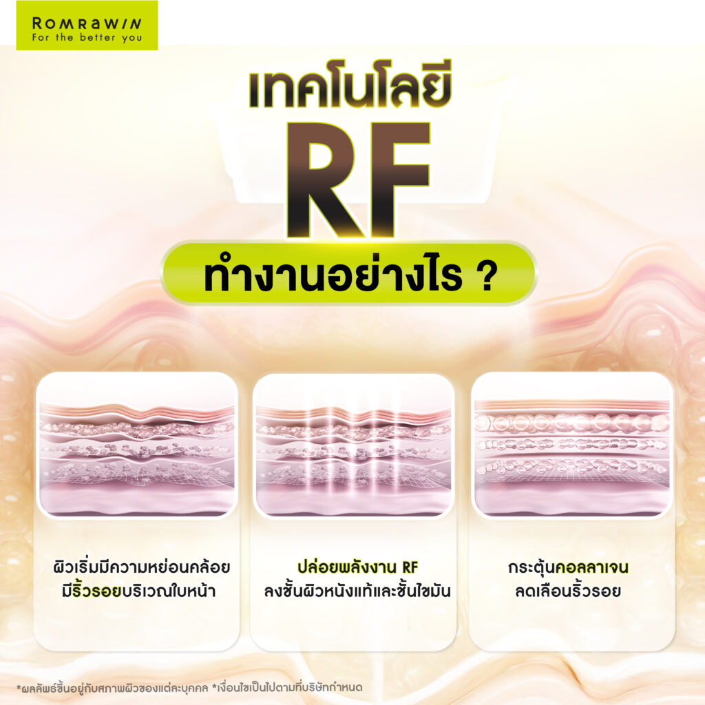 ทำความรู้จักเทคโนโลยี RF (Radio Frequency)