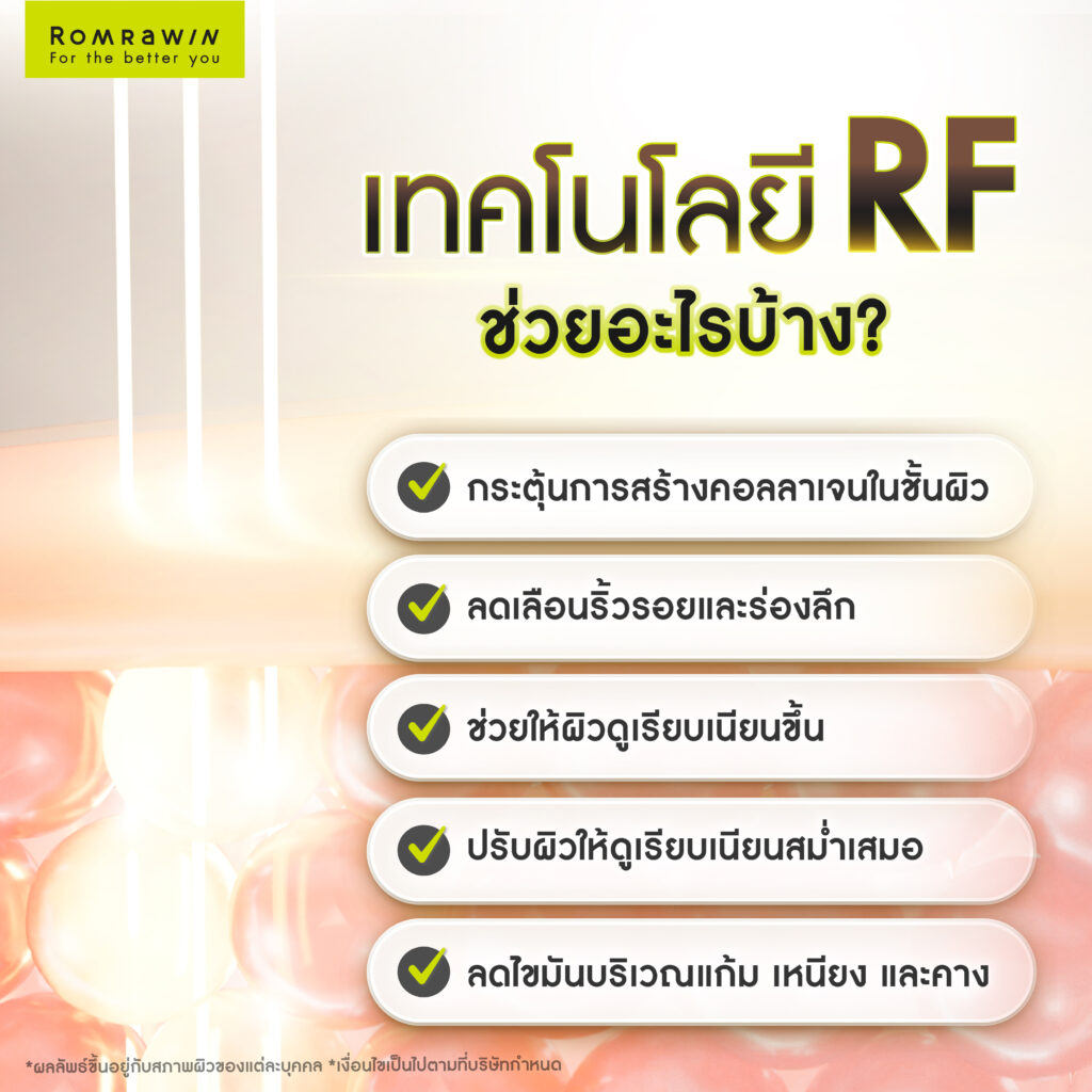 เทคโนโลยี RF (Radio Frequency) ช่วยอะไรได้บ้าง?