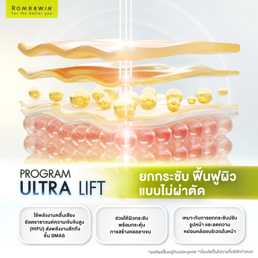 ยกกระชับหน้า Ultra Lift คืออะไร?