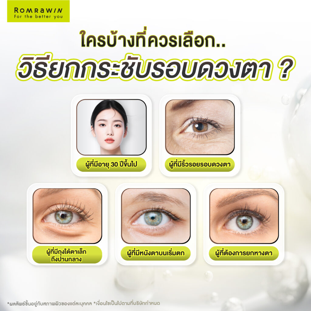 ใครบ้างที่ควรเลือกวิธียกกระชับรอบดวงตา?